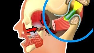 Besonderheiten des Kiefergelenks [upl. by Anirbes]