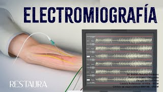 ¿Qué es la electromiografía [upl. by Sjoberg]