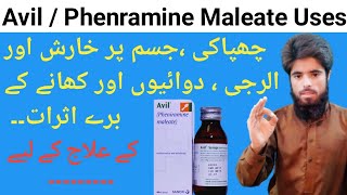 Avil  Pheniramine Maleate  Avil Uses In Urdu  Anti Allergic Medicne  Skin Disease  Ijaz Ahmad [upl. by Enram]