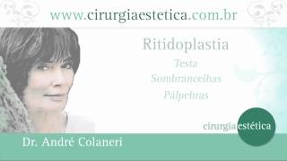 Lifting Facial  Cirurgia Plástica da Face Como é Dr Andre Colaneri explica [upl. by Dzoba]