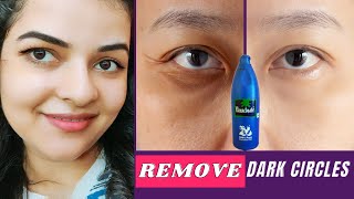 How to Remove Dark Circles Naturally in 3 Days with Coconut Oil 100 Results  Remove Dark Circles [upl. by Essirahc]