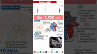 S3 Heart Sound  TERCER R3 RUIDO CARDIACO  SEMIOLOGÍA FÁCIL Auscultación Cardíaca galopenormal [upl. by Ahseikan719]