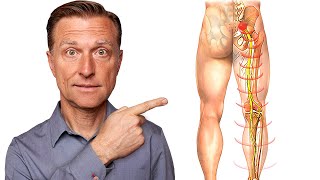 Say Goodbye to Sciatica Nerve Pain in 5 Minutes [upl. by Ambrogio255]