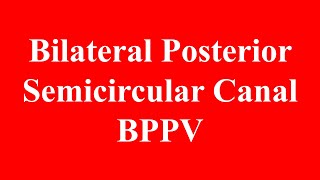 Bilateral Apogeotropic Posterior Semicircular Canal BPPV [upl. by Agee518]