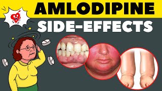 Amlodipine Side Effects amp How to Avoid  Amlodipine Adverse Effects [upl. by Crissie]