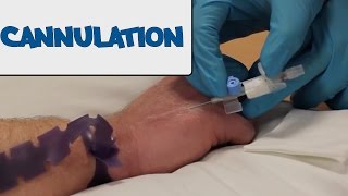 How to Perform Cannulation  OSCE Guide old version  UKMLA  CPSA [upl. by Ytsur477]