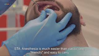 Painless Computerized Dental Anesthesia at Neoclinique EN [upl. by Nilek]