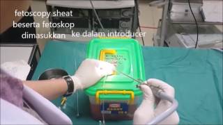 Fetoscopy training amp simulation [upl. by Astri5]