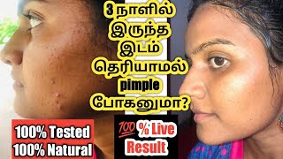 How to remove pimple at home in tamilHome remedies for pimplesHow to get rid of pimples [upl. by Notneiuq]