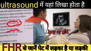 meri ultrasound se jane ladka ya ladki ultrasound report boy or girlultrasound [upl. by Enywtna]