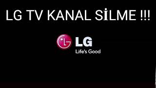 LG tv kanal silme silememe problemi 📺 [upl. by Hcirdeirf]