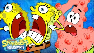 Most PAINFUL Moments in Bikini Bottom 😵  SpongeBob [upl. by Maddalena]