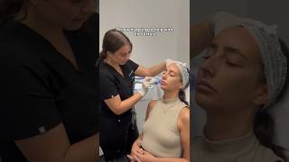 From Skin Assessment to Radio Frequency Microneedling at Dr Medispa Knightsbridge [upl. by Gnilhsa222]