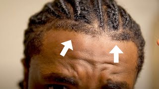 How To Get The Perfect Front Taper Hairline Side Taper amp Back Taper  Braids Dreads Twist amp Afro [upl. by Eimilb]