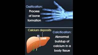 Ossification Vs Calcification [upl. by Adnah]