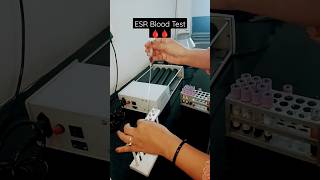 ESR Erythrocyte Sedimentation rate 🩸🩸🧑‍🔬💉blood infectionTest Procedure amp result status shorts [upl. by Eniak]