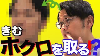 【美容動画】きむホクロを取る！？【インディアンス】【ホクロ除去】 [upl. by Bucher]