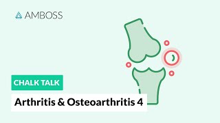 Arthritis amp Osteoarthritis  Part 4 Joint Involvement Patterns in Rheumatic Diseases [upl. by Eugen778]