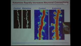 New Mechanisms Elicited with Ketamine in TreatmentResistant Depression [upl. by Nats]