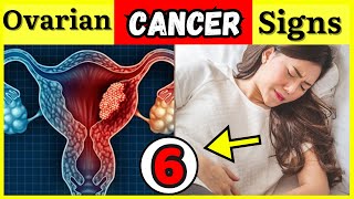 6 Signs of Ovarian CANCER  You Should Never Ignore [upl. by Yrral]