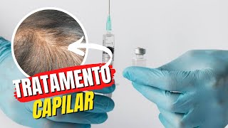 Tratamento Capilar com Intradermoterapia e MMP [upl. by Eramal]