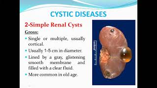 MED Level 2 URO Congenital Anomalies amp Cystic Diseases of the Kidney 16 5 2021 [upl. by Airehs502]