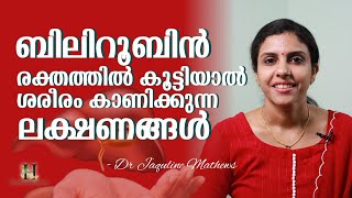 Bilirubin  ബിലിറൂബിൻ കൂടിയാൽ ശരീരം കാണിക്കുന്ന ലക്ഷണങ്ങൾ  Dr Jaquline Mathews BAMS [upl. by Harod613]