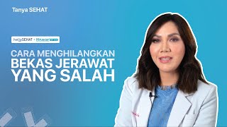 Cara Menghilangkan Bekas Jerawat yang Salah [upl. by Lirbaj]