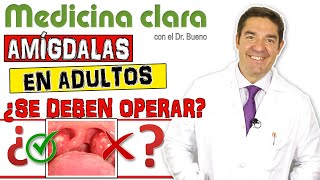 AMÍGDALAS EN ADULTOS ¿Se deben OPERAR AMIGDALECTOMÍA  Medicina Clara [upl. by Hemingway]