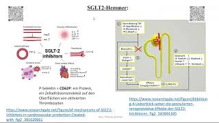 Herzinsuffizienz Therapie 6 SGLT2 Hemmer und Vericiguat [upl. by Eelinnej56]