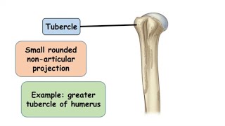 Tubercle Bone Marking [upl. by Aleyam]