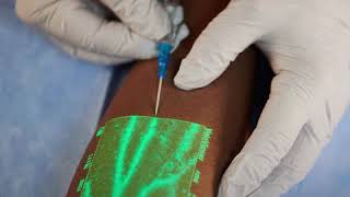 New medical technology helps nurses insert an IV on the first try [upl. by Yul]