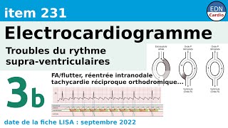 231  Electrocardiogramme ECG  Partie 3b  Troubles du rythme supraventriculaires [upl. by Halonna79]