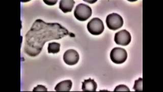 Neutrophil Phagocytosis  White Blood Cell vs Staphylococcus Aureus Bacteria [upl. by Yee]