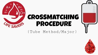 Crossmatching Procedure  Tube methodMajor [upl. by Novaj]