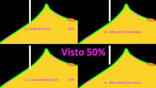 El umbral de visión  Centro de Oftalmología Bonafonte Barcelona [upl. by Sair]