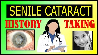 Senile Cataract Case Presentation History Taking amp Possible Viva Questions  Ophthalmology [upl. by Ioab]