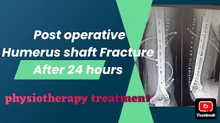 POST OPERATIVE HUMERUS FRACTURE AFTER 24HR  PHYSIOTHERAPY TREATMENT EXERCISE [upl. by Zetta]