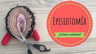 La EPISIOTOMIA ✂️ ¿cómo puedo evitarla [upl. by Laine]