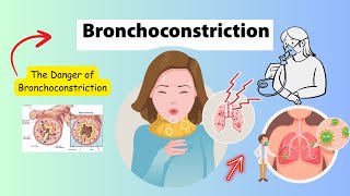 Bronchoconstriction Care and Management [upl. by Notseh281]