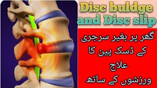 Backpain treatment by dr warda  S6  Exercises for disc pain  UrduHindi [upl. by Ysnat]