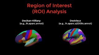 FreeSurfer 11 ROI Analysis [upl. by Ttenaj223]