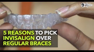 Get The Perfect Smile Through Invisible Treatment With Invisalign  Curly Tales [upl. by Laura]