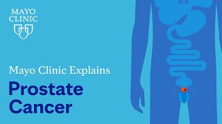 Mayo Clinic Explains Prostate Cancer [upl. by Westleigh]