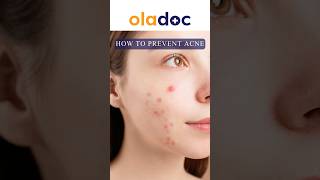 How To Prevent Acne  Dane Hone Se Kaise Roken  پمپلز ہونے سے کیسے روکیں؟ shorts acnetreatment [upl. by Grearson]