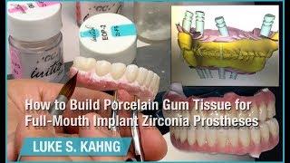 How to Build Porcelain Gum Tissue for FullMouth Implant Zirconia Prostheses [upl. by Onahpets651]