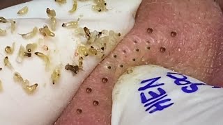 Satisfying video with Hien Nguyen Spa Da Nang 011 [upl. by Stav]