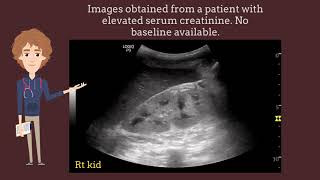 Increased renal cortical echogenicity on ultrasound is not always chronic kidney disease I POCUS [upl. by Plath281]