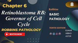 Retinoblastoma RB Governor of Cell Cycle  RB Pathway Neoplasia Lecture 8 Robbins Patho Chapter 6 [upl. by Attoynek]