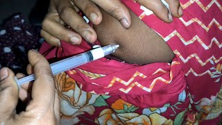 Arm IM Soma Ject Injection Push √√ Injection Videoজন্মবিরতিকরণ ইনজেকশন Ep 45 Injection Vision [upl. by Aroled]